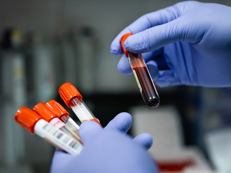 Hands with blue gloves holding vials of blood specimens.