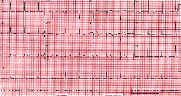 All Is Not Well AAFP