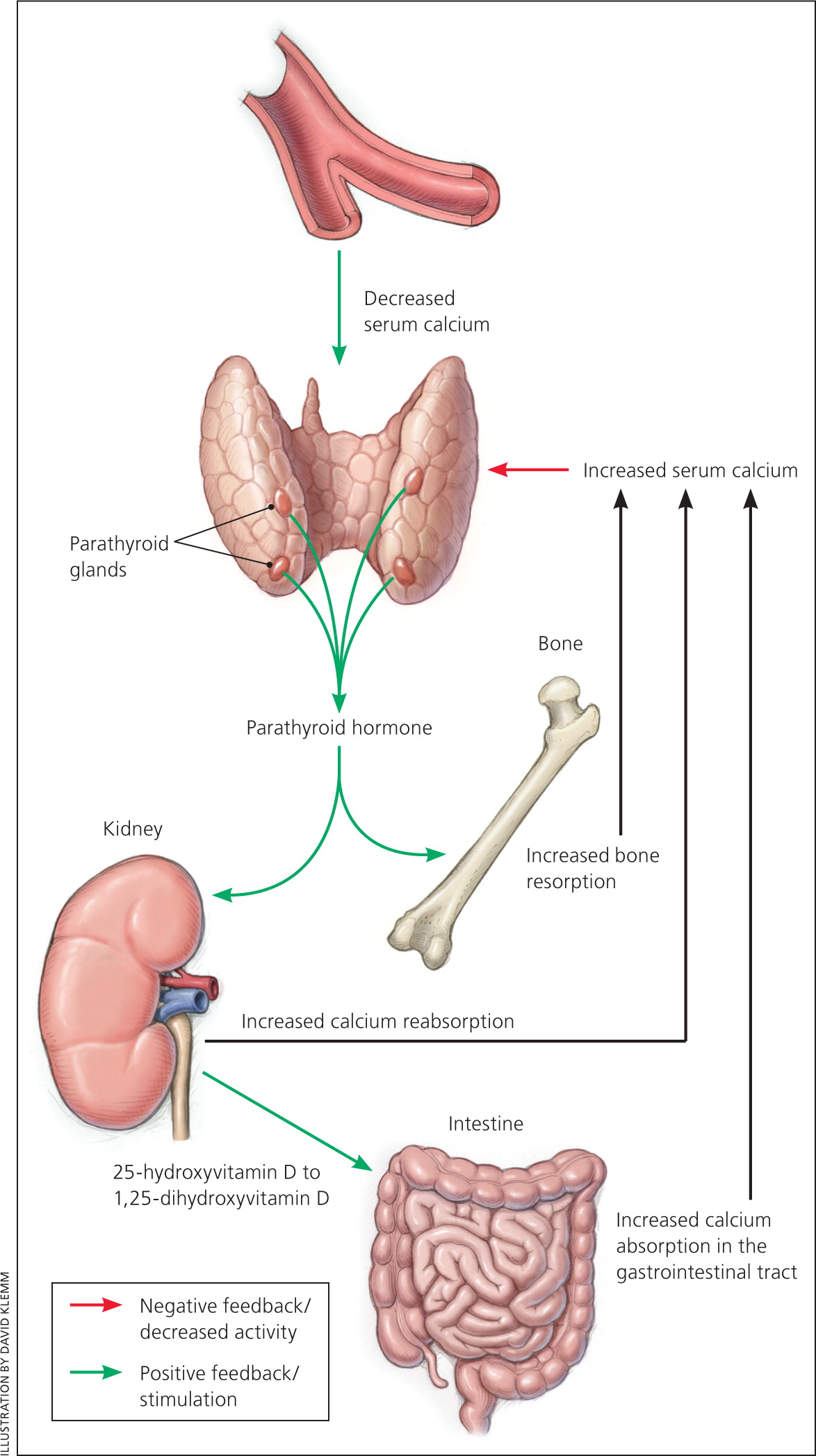 Parathyroid Disorders AAFP