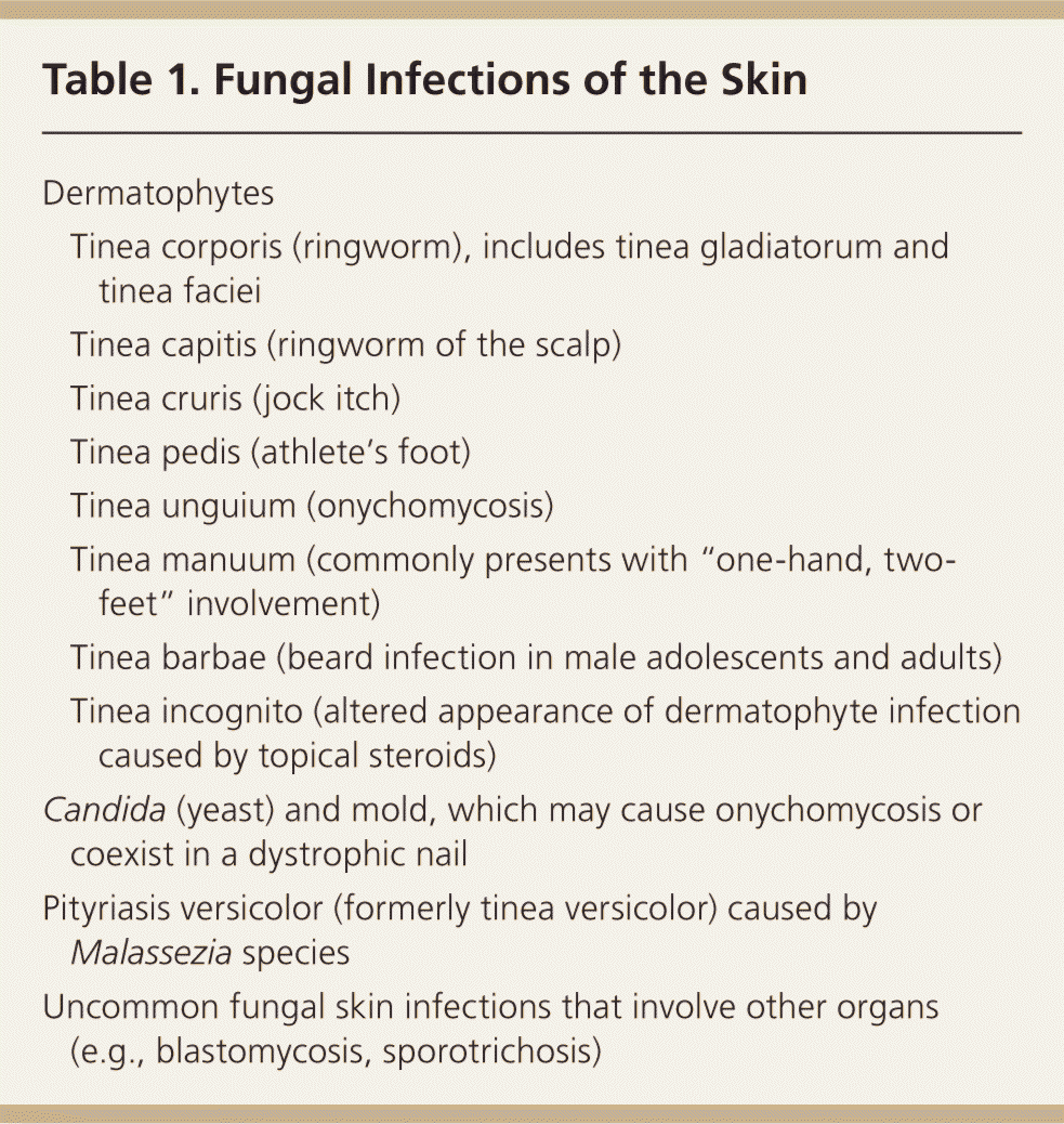 Diagnosis And Management Of Tinea Infections AAFP