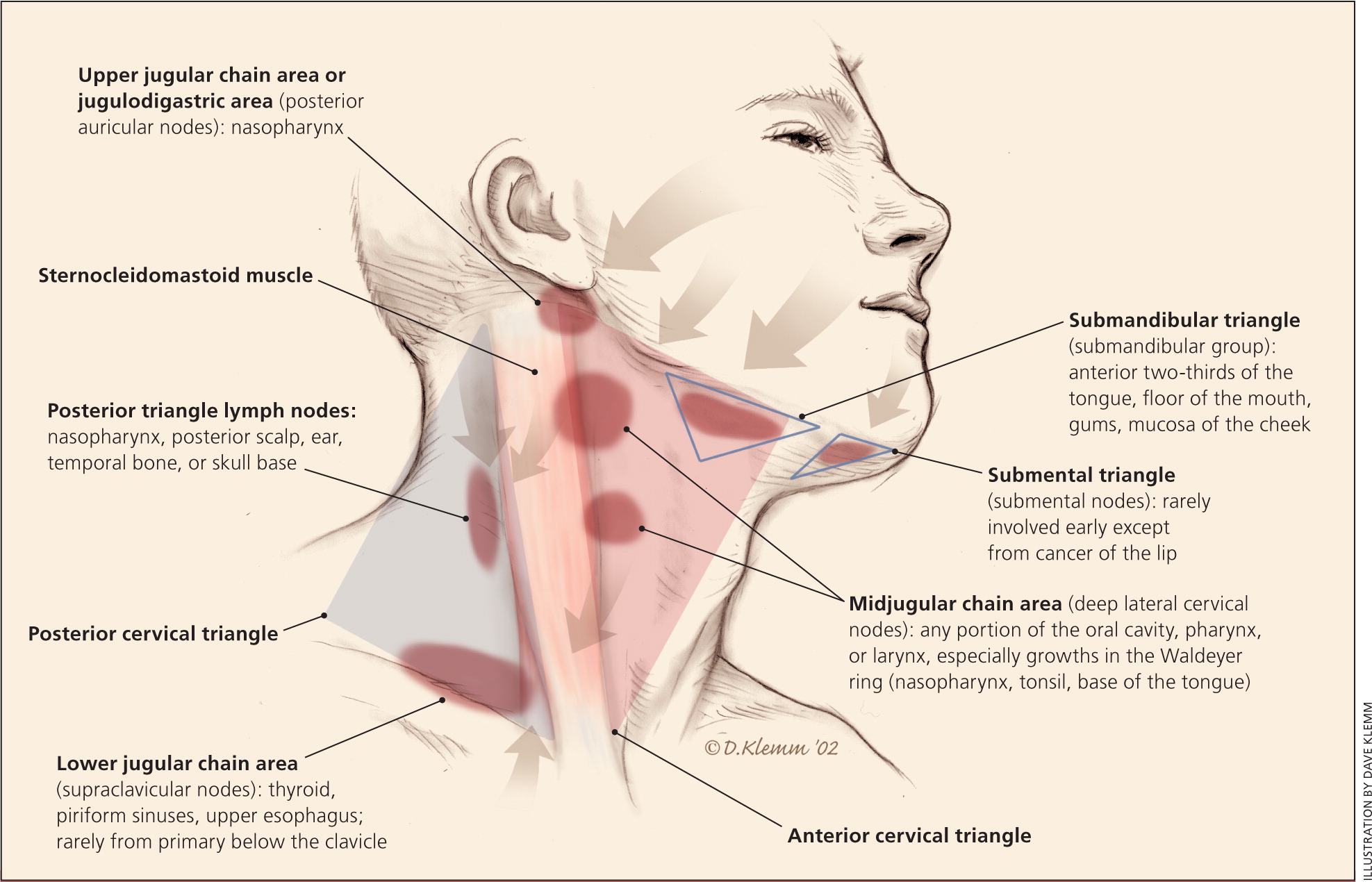 pea sized lymph node back of neck