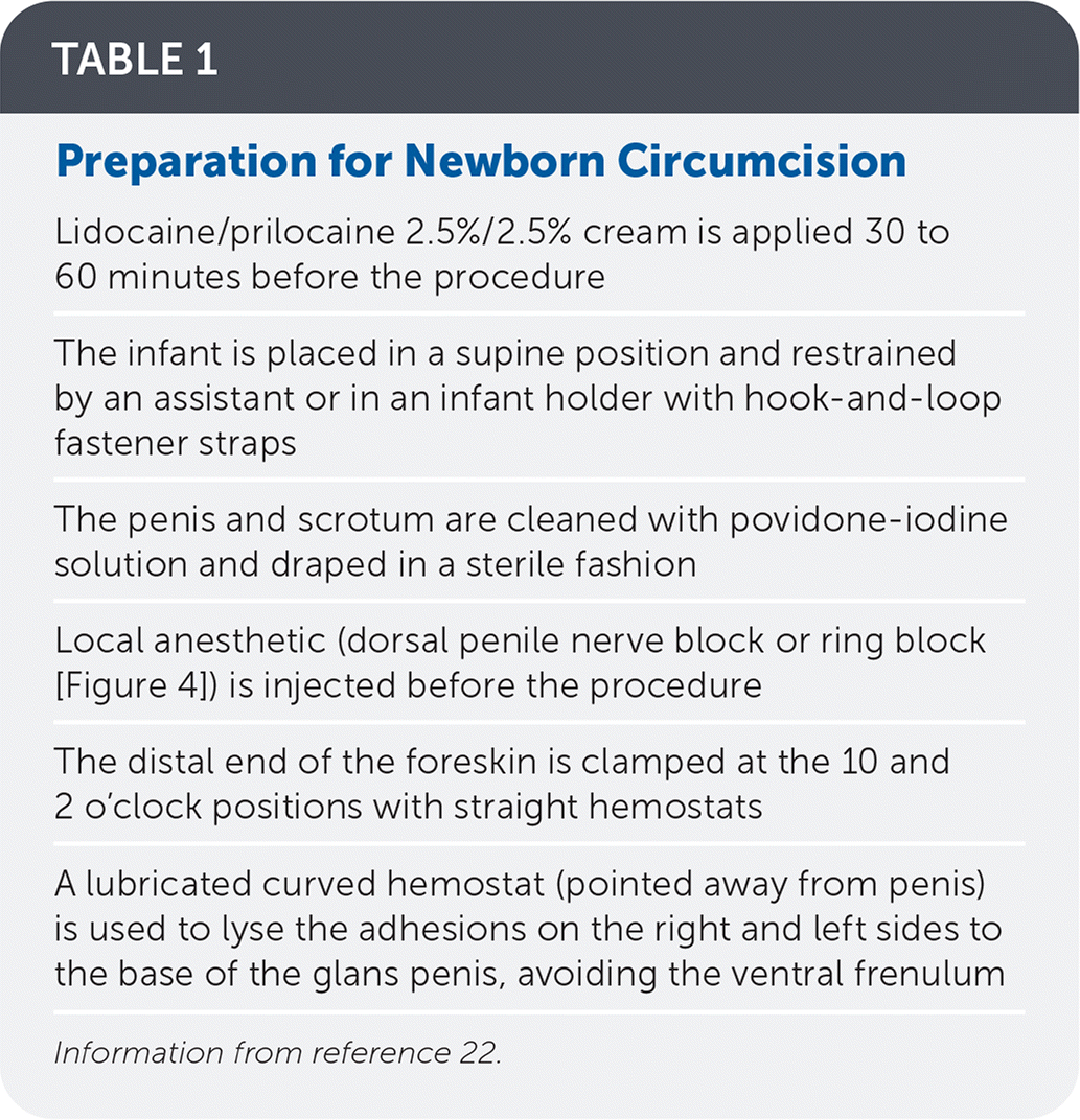 Types Of Circumcision Procedures