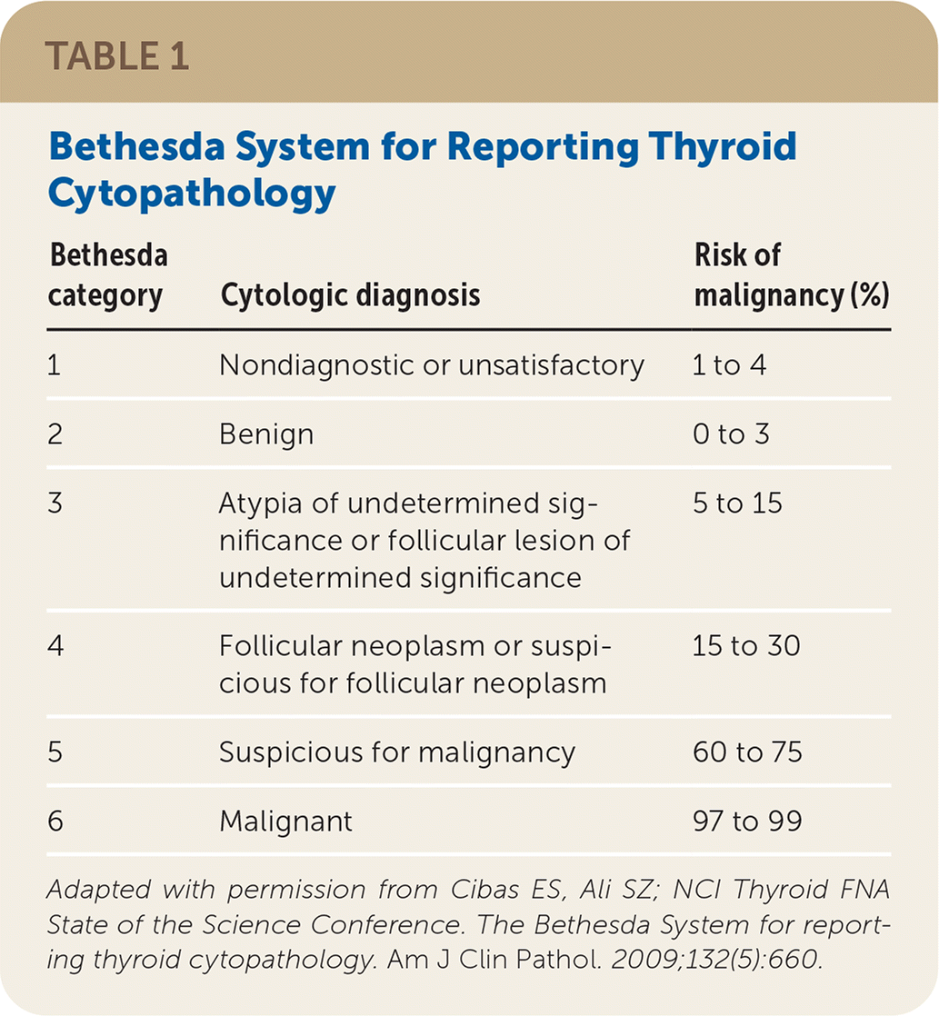 Thyroid Nodules