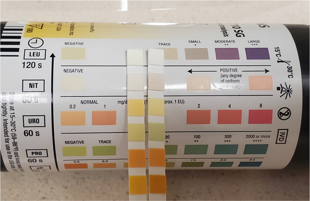 Office Based Urinalysis A Comprehensive Review Aafp 5227