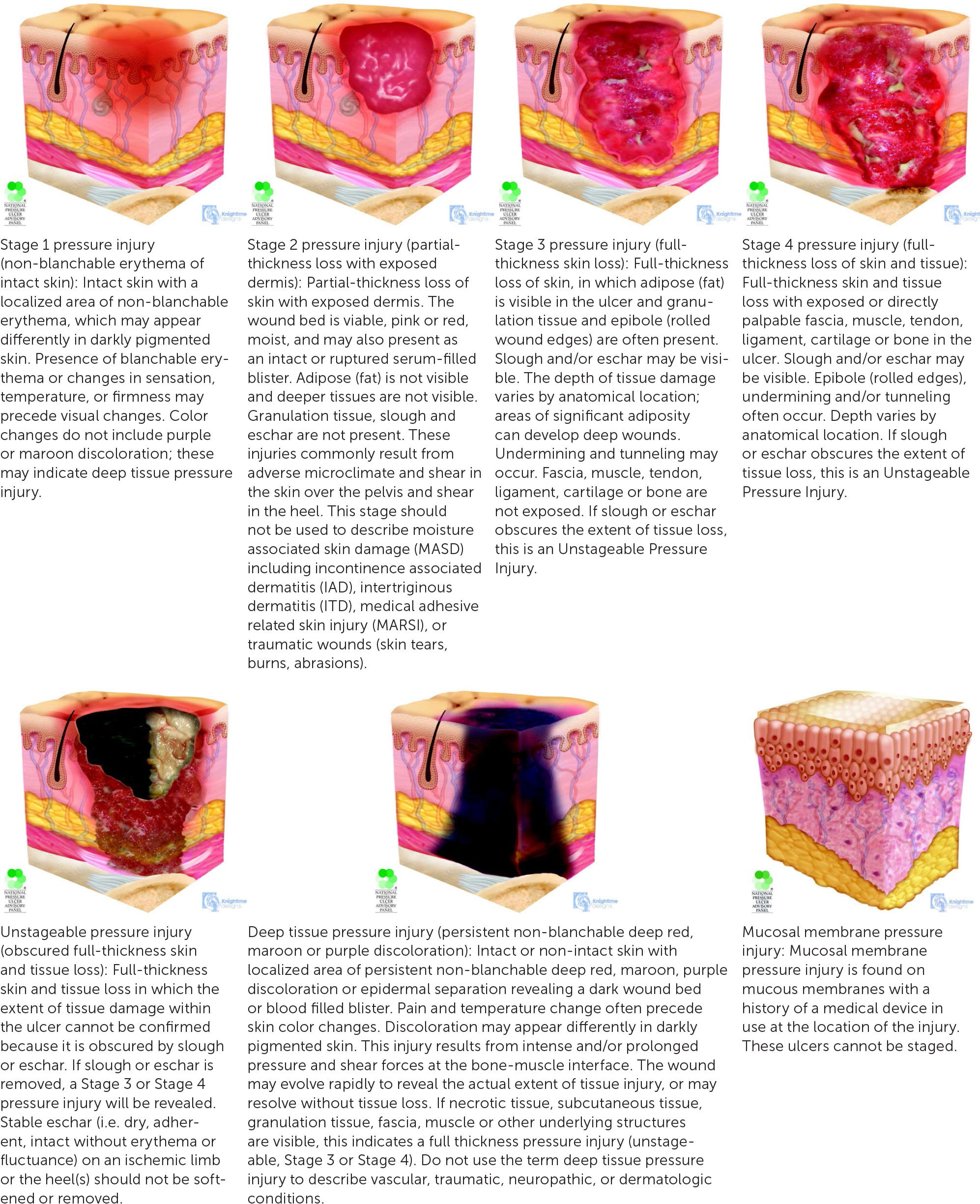 Pressure Ulcers: Prevention, Evaluation, and Management