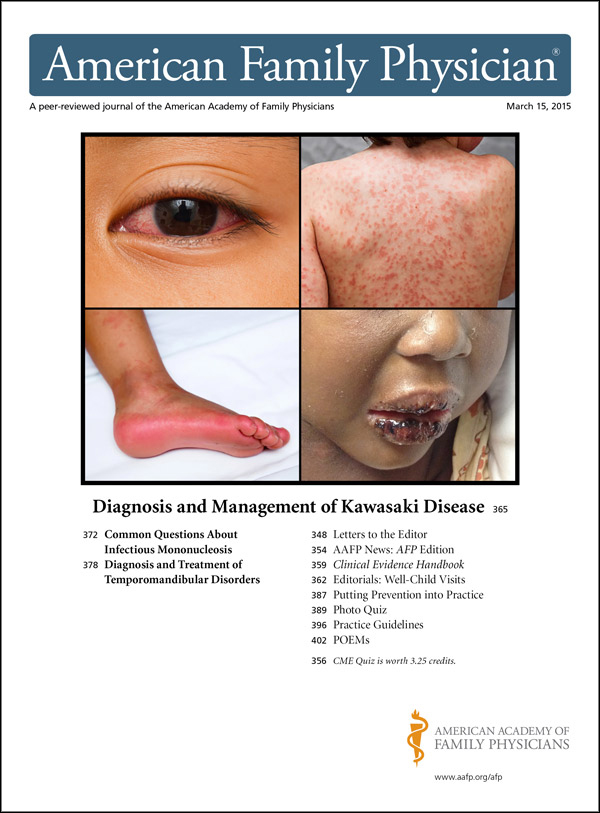 kawasaki disease in adults