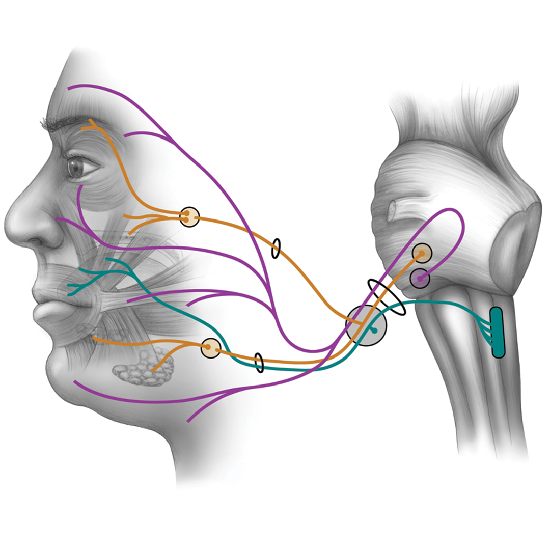 facial nerve palsy pathway